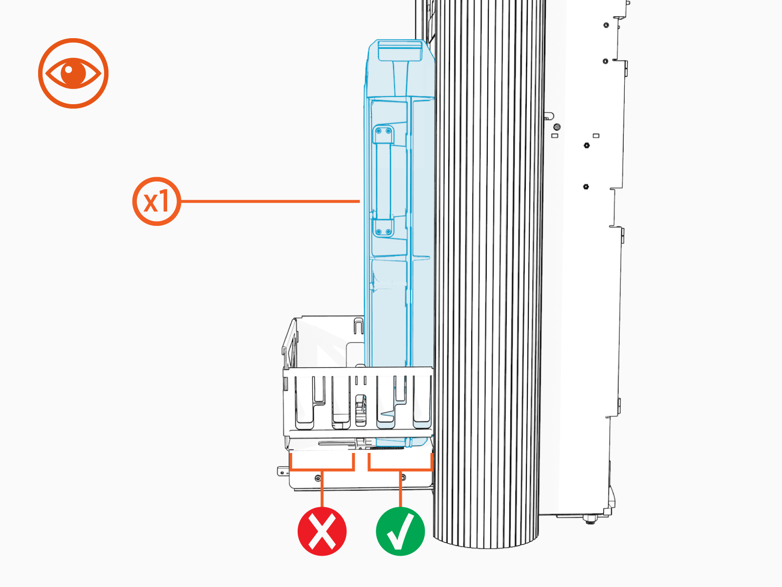 Technical illustration depicts the procedural step.